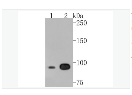 Anti-CLOCK  antibody-生物钟基因hClock重组兔单克隆抗体