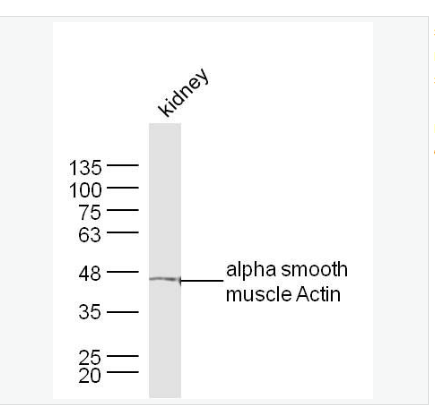 Anti-alpha smooth muscle Actin  antibody-肌动蛋白α/α-SMA/α Actin抗体