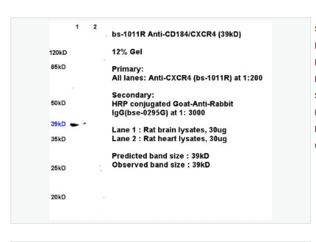 Anti-CXCR4 antibody-细胞表面趋化因子受体4抗体