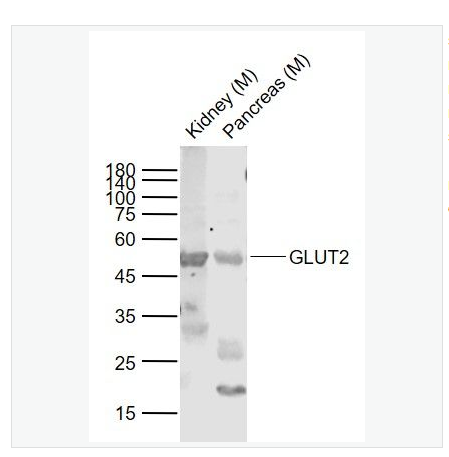 Anti-GLUT2 antibody-葡萄糖转运蛋白2抗体