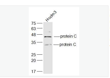 Anti-protein C  antibody-维生素K依赖的蛋白C重链抗体