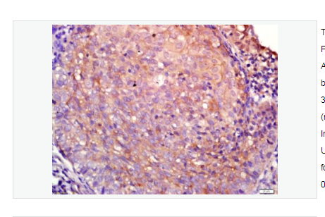 Anti-Aquaporin 4   antibody-水通道蛋白4抗体