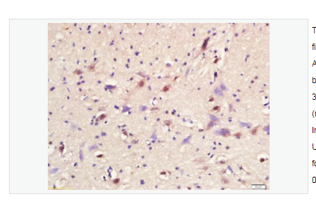 Anti-ASCL1 antibody-神经母细胞特异性转移因子抗体