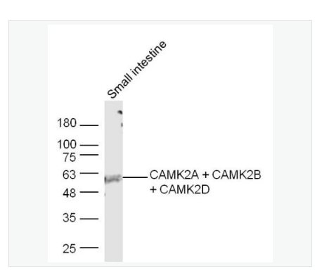 Anti-CAMK2A + CAMK2B + CAMK2Dantibody-钙/钙调素依赖蛋白激酶2b/2γ抗体