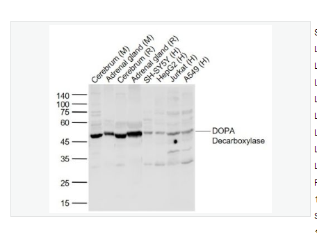  Anti-DOPA Decarboxylase antibody-多巴胺脱羧酶抗体
