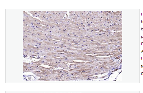 Anti-Desmin antibody-结蛋白抗体