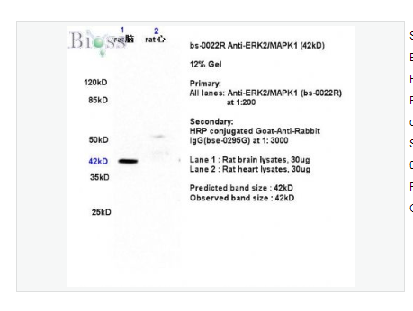 Anti-ERK1 + ERK2 antibody-丝裂原活化蛋白激酶1/ERK 1/2抗体