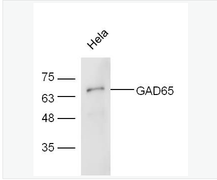 Anti-GAD65 antibody-谷氨酸脱羧酶-65抗体