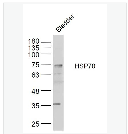 Anti-HSP70 antibody-热休克蛋白-70抗体