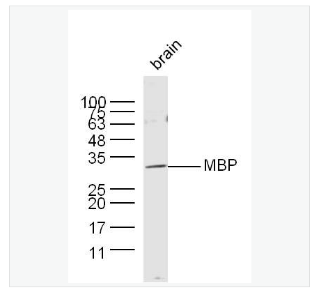 Anti-MBP antibody -髓鞘碱性蛋白/磷脂碱性蛋白抗体