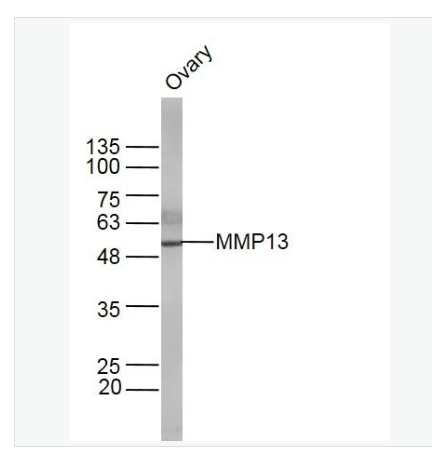 Anti-MMP13 antibody-基质金属蛋白酶13抗体
