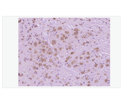 Anti-Neurocan antibody-神经粘蛋白抗体