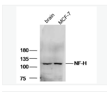 Anti-NF-H antibody-高分子量神经丝蛋白抗体