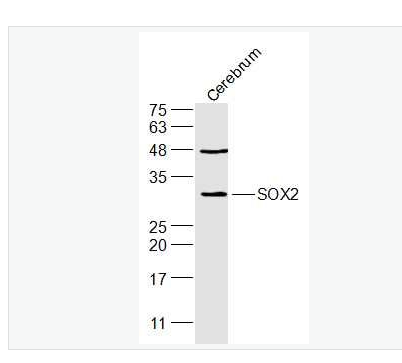Anti-SOX2 antibody-胚胎干细胞关键蛋白抗体