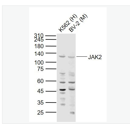 Anti-JAK2 antibody-蛋白质酪氨酸激酶JAK2抗体