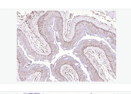 Anti-P73 antibody-肿瘤蛋白P73抗体