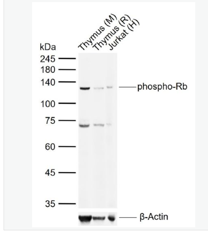 Anti-phospho-Rb (Ser780) antibody-磷酸化成视网膜细胞瘤抑癌蛋白抗体
