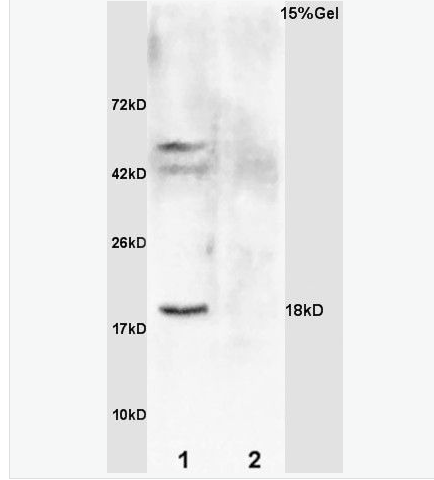 Anti-GADD45A antibody-生长抑制DNA损伤基因45抗体