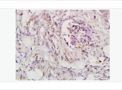 Anti-LIFR antibody-白血病抑制因子受体（CD118）抗体