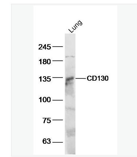 Anti-IL6ST/CD130 antibody-白细胞介素6受体β/CD130抗体