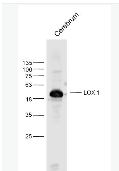 Anti-LOX 1 antibody-凝集素样氧化型低密度脂蛋白受体抗体
