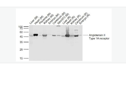 Anti-Angiotensin II type 1A receptor antibody-血管紧张素Ⅱ1A型受体抗体