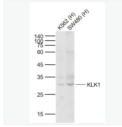 Anti-KLK1 antibody-激肽释放酶1抗体