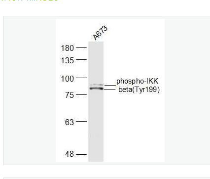 Anti-phospho-IKK beta (Tyr199) antibody-磷酸化KB抑制蛋白激酶β抗体