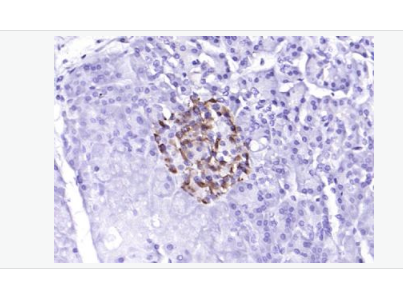 Anti-Phospho-PERK (Thr980) antibody-磷酸化蛋白激酶样内质网激酶抗体