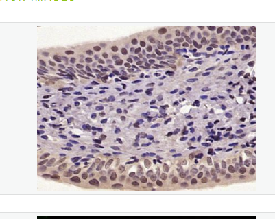 Anti-Phospho-NFKB p65 (Ser276) antibody-磷酸化细胞核因子NF-κB p65抗体