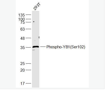 Anti-Phospho-YB1 (Ser102) antibody-磷酸化转化生长因子β活化激酶1