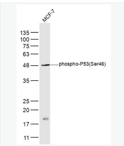 Anti-phospho-P53 (Ser46) antibody-磷酸化肿瘤抑制基因P53抗体