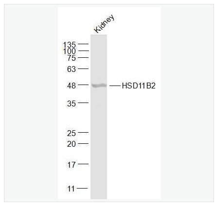 Anti-HSD11B2 antibody-羟基类固醇脱氢酶11β2抗体
