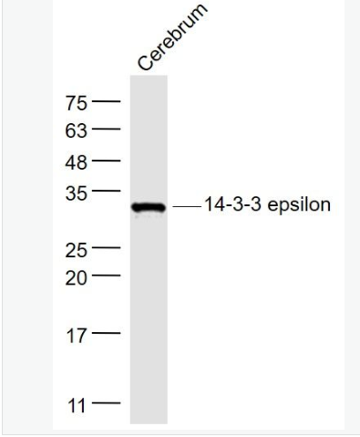 Anti-14-3-3 epsilon antibody-14-3-3E蛋白抗体