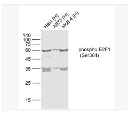 Anti-phospho-E2F1 (Ser364) antibody-磷酸化转录因子E2F-1抗体