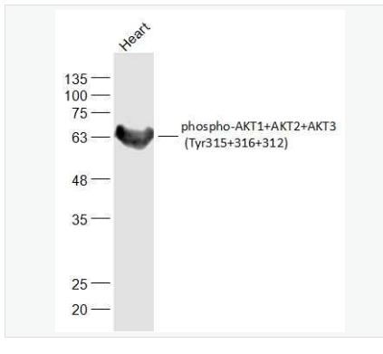 Anti-phospho-AKT1+AKT2+AKT3 (Tyr315+316+312)  antibody-磷酸化蛋白激酶AKT1,2,3抗体