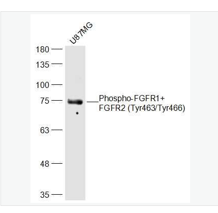 Anti-Phospho-FGFR1+FGFR2 (Tyr463/Tyr466)  antibody-磷酸化碱性成纤维细胞生长因子受体1/2（CD331/CD332）抗体