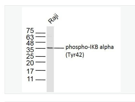 Anti-phospho-IKB alpha (Tyr42)  antibody-磷酸化IKB α抗体