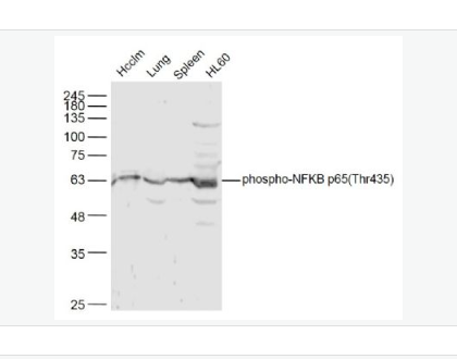 Anti-phospho-NFKB p65 (Thr435) antibody-磷酸化细胞核因子抗体