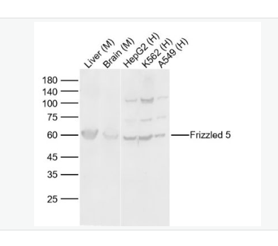 Anti-Frizzled 5 antibody-Wnt信号受体蛋白抗体