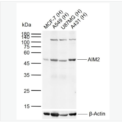 Anti-AIM2 antibody-干扰素诱导蛋白AIM2抗体