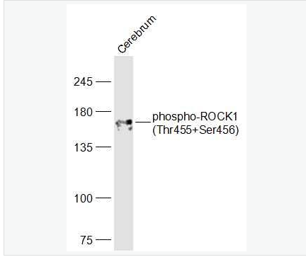 Anti-phospho-ROCK1 (Thr455+Ser456) antibody-磷酸化Rho相关蛋白激酶1抗体