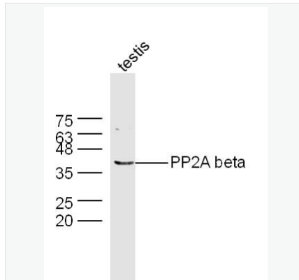 Anti-PP2A alpha + beta antibody-蛋白质磷酸酶2A （alpha + beta）抗体