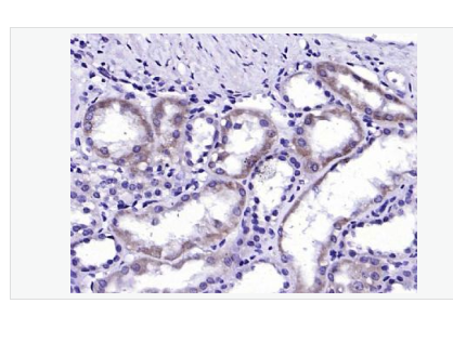 Anti-ALAS1 antibody-5-氨基乙酰丙酸合酶1抗体