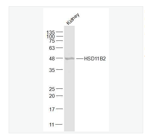Anti-HSD11B2  antibody-羟基类固醇脱氢酶11β2抗体