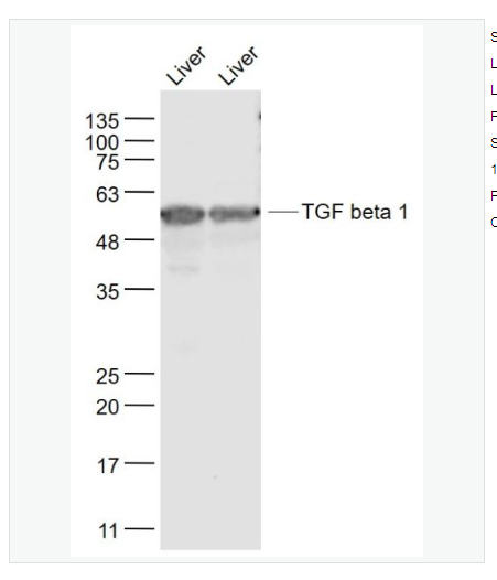 Anti-TGF beta 1  antibody-转化生长因子β1/TGF β1/TGF-β1抗体