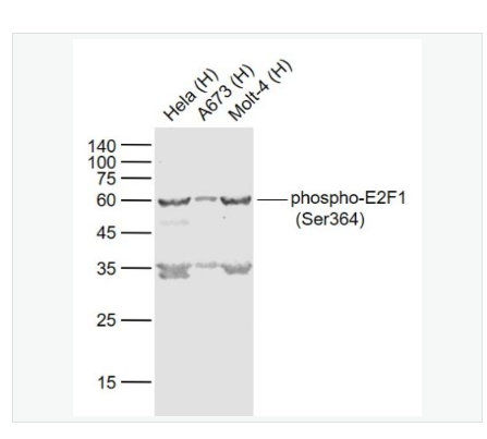 Anti-phospho-E2F1 (Ser364) antibody   -磷酸化转录因子E2F-1抗体