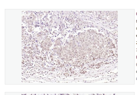 Anti-phospho-BRAF antibody   -磷酸化B-Raf抗体