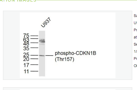 Anti-phospho-CDKN1B antibody   -磷酸化P27抗体/周期素依赖激酶抑制剂抗体