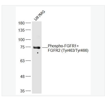 Anti-Phospho-FGFR1+FGFR2 antibody   -磷酸化碱性成纤维细胞生长因子受体1/2（CD331/CD332）抗体